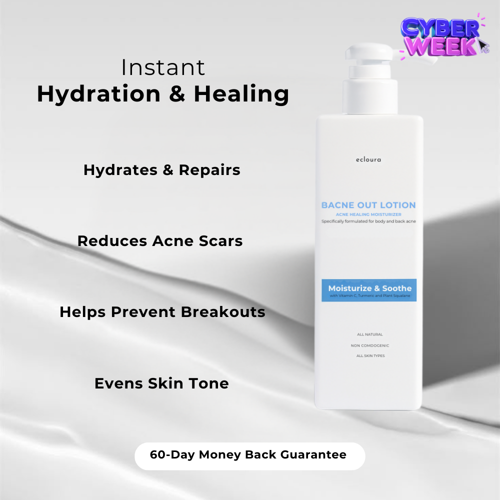 Bacne Out Lotion™
