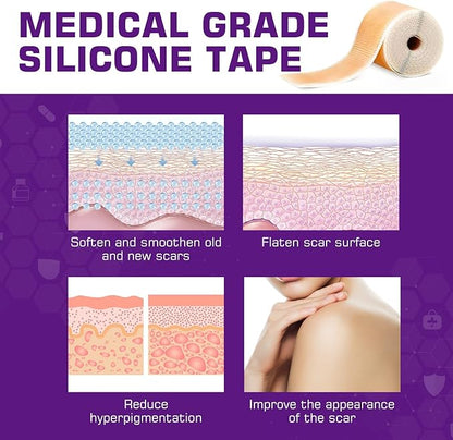 Ecloura Silicone Scar Tape™